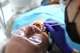 Stomatolog na NFZ: Sprawdź, co możesz wyleczyć za darmo u dentysty. Tak wygląda bezpłatne leczenie jamy ustnej w ramach NFZ