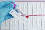 W Inowrocławiu odbędą się bezpłatne badania w kierunku HIV, HCV oraz kiły