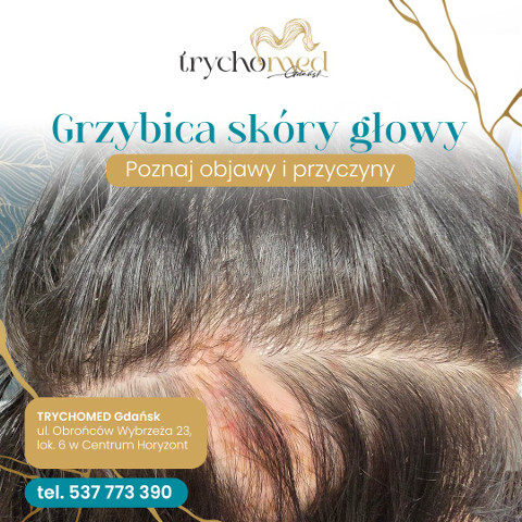 Klinika TrychoMed , Gdańsk