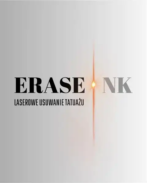 Zenit Tattoo Studio Tatuażu Szczecin Laserowe Usuwanie Tatuażu, Szczecin